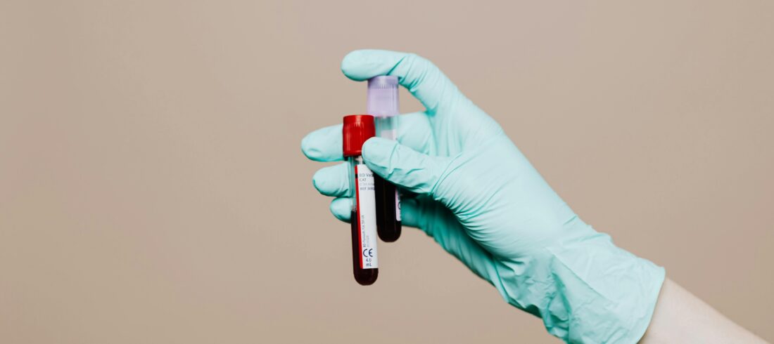 sumber pexels hematologia