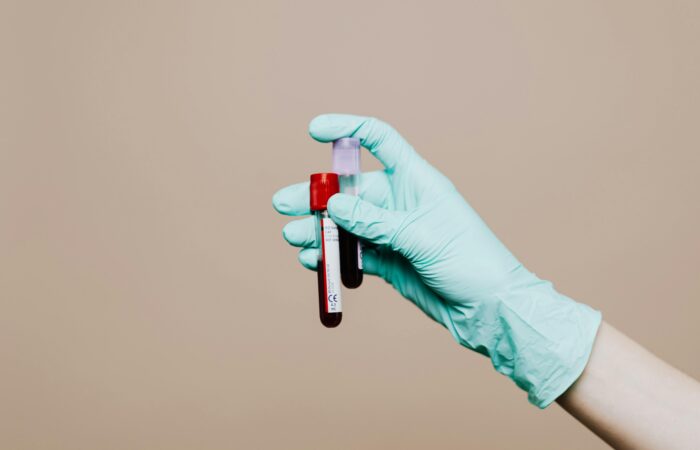 sumber pexels hematologia
